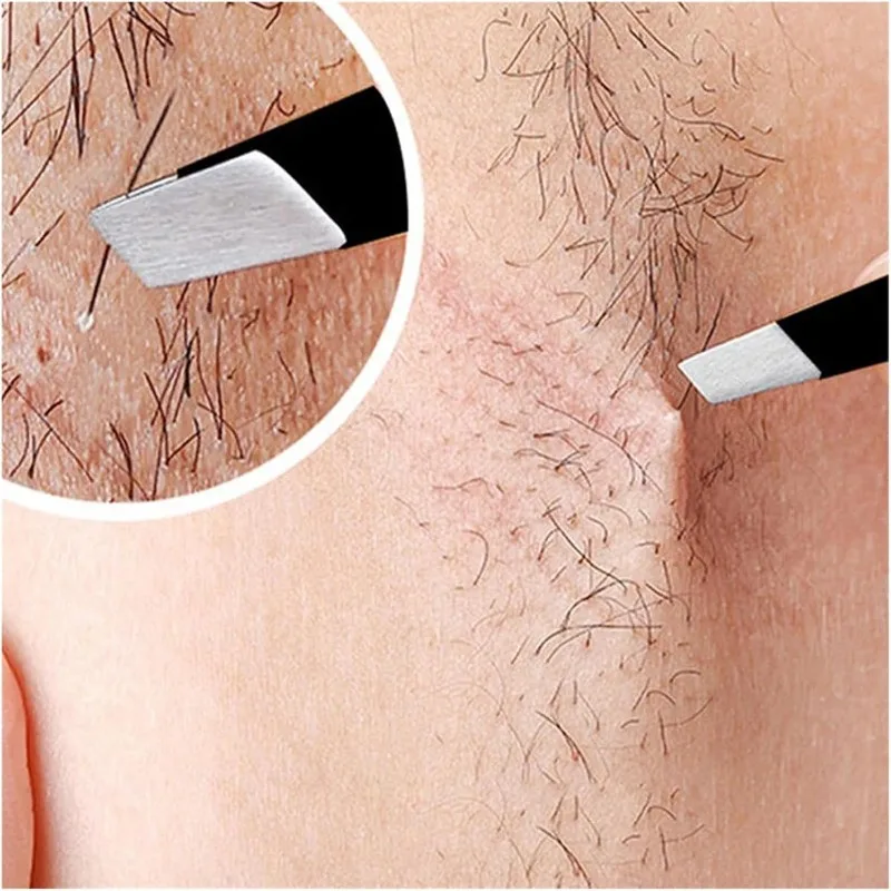 4Pcs Professional Tweezers Set, Slanted, Pointed, Bent & Flat Tips for Eyebrow, Ingrown Hair & Debris Removal