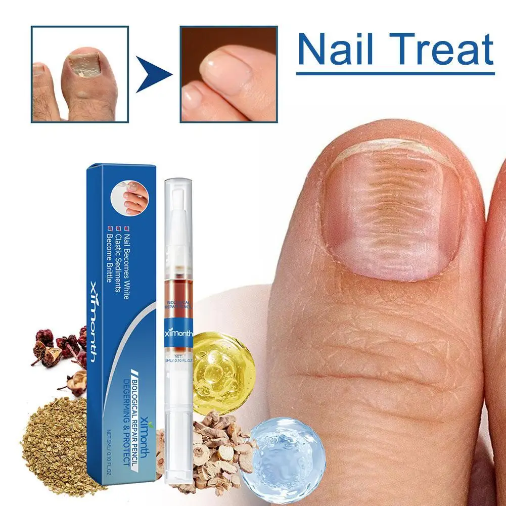 

3ml Nail Fungal Liquid,Repair Nail Fungus Fungal Removal Gel Anti-Infection Onychomycosis Feet Health Care