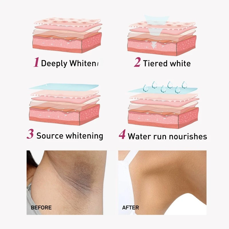 Onderarm Whitening Cream Hydraterende Reparatie Okselgewricht Knie Bleken Witte Huid Donkere Vlek Verwijderen Melanine Lichaam Bleken