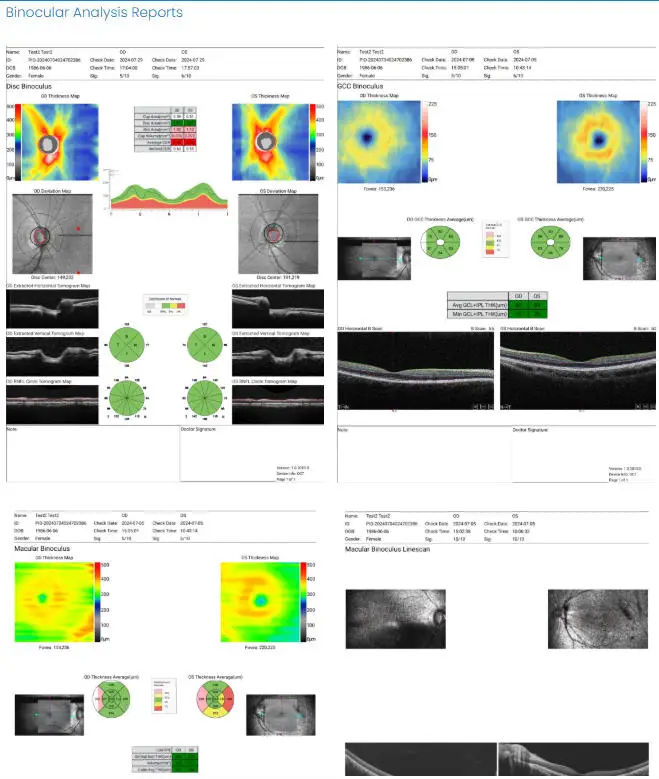 Optical Coherence Tomography RetiView 500 No Ionizing Radiation Eyeball Back Three-dimensional Image Eye Tester Optics