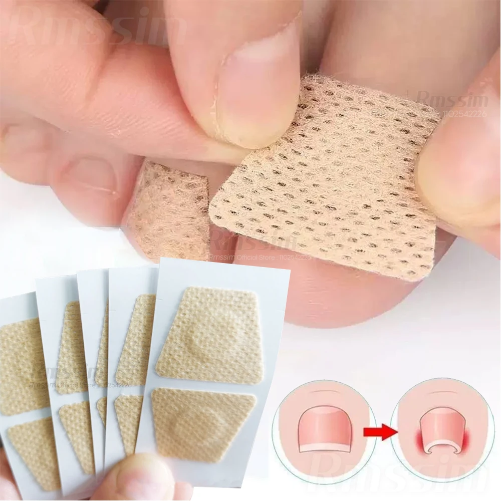 

30/60/120pcs Toenail Fungus Treatment Stickers Ingrowning Toenail Corrector Repair Patch Fungus Removal Nail Repair Patch