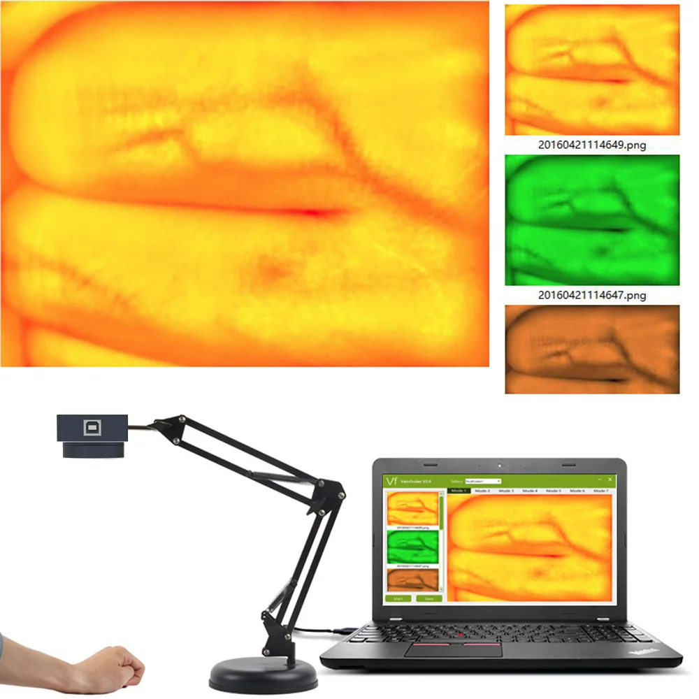 Mobile Vein Finder Vein Imaging Device Back of Hand Puncture Examination Vascular Medical Professional Accessories