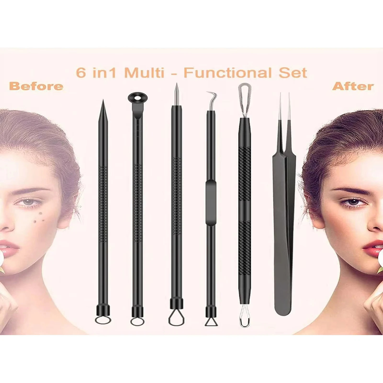 6-Piece Hot-Selling Acne Removal Kit - Stainless Steel Tools for Blackhead & Pimple Extraction Facial Skin Care & Pore Cleansing