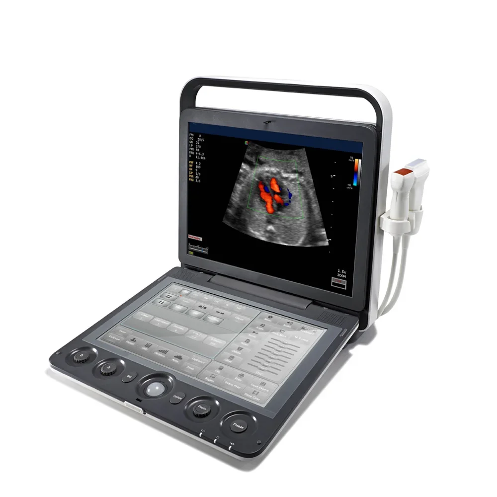 Sonoscape E2 Medical Ultrasound ultrasonic Instruments, Portable Color Doppler 4D Ultrasound Machine