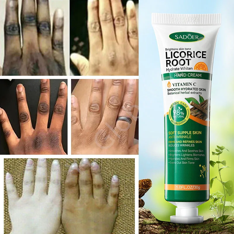 

Fast Whitening Dark Knuckles Brighten Hand Cream Melanin Corrector Moisturizing Intense Stains Remover Products Skin Care