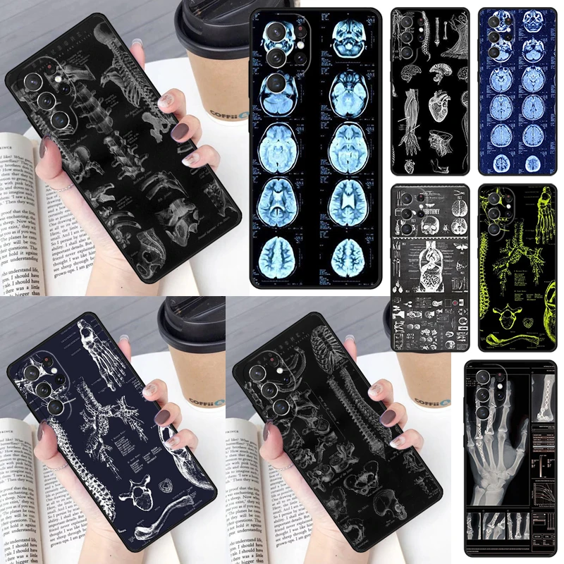 Radiological Human Organs Skeleton Cover For Samsung Galaxy S23 Ultra S22 S20 S21 FE S8 S9 S10 Plus Note 10 20 Ultra phone Case