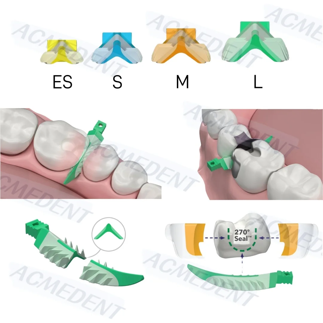 Mieszane rozmiary Dental Composite Wedge Strata Wedges Soft Face Cervical Seal Diastema Wedge Matrix Band Fit Garrison 100pcs/box