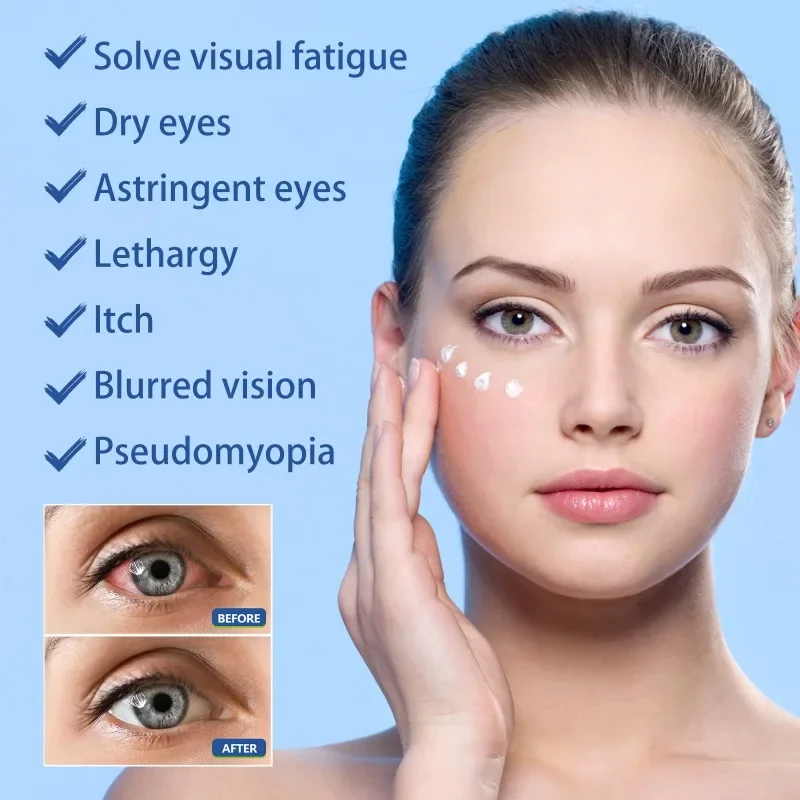 Eye Care Cream stay up late Protection vision Relieves Red Eyes Discomfort Dry Itchy eye fatigue Relax Moisturizing Ointment