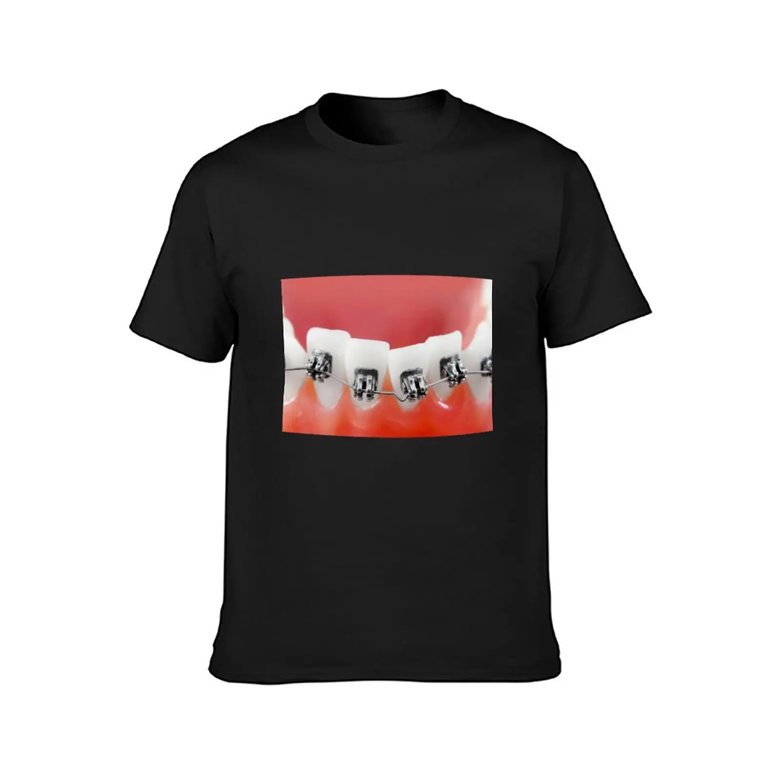 Dental braces T-Shirt graphics korean fashion men clothings