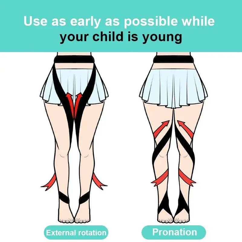 1 Set Children O/X Leg Shape Correction Belt-Adjustable Bowed Knee Valgum Straightening Posture Corrector for Men Women