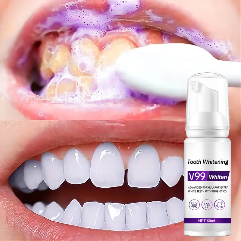 Tooth Cleansing Mousse V99 Purple Whitening Toothpaste Remove Stains Reduce Yellowing Care For Teeth Gums Fresh Breath 2023