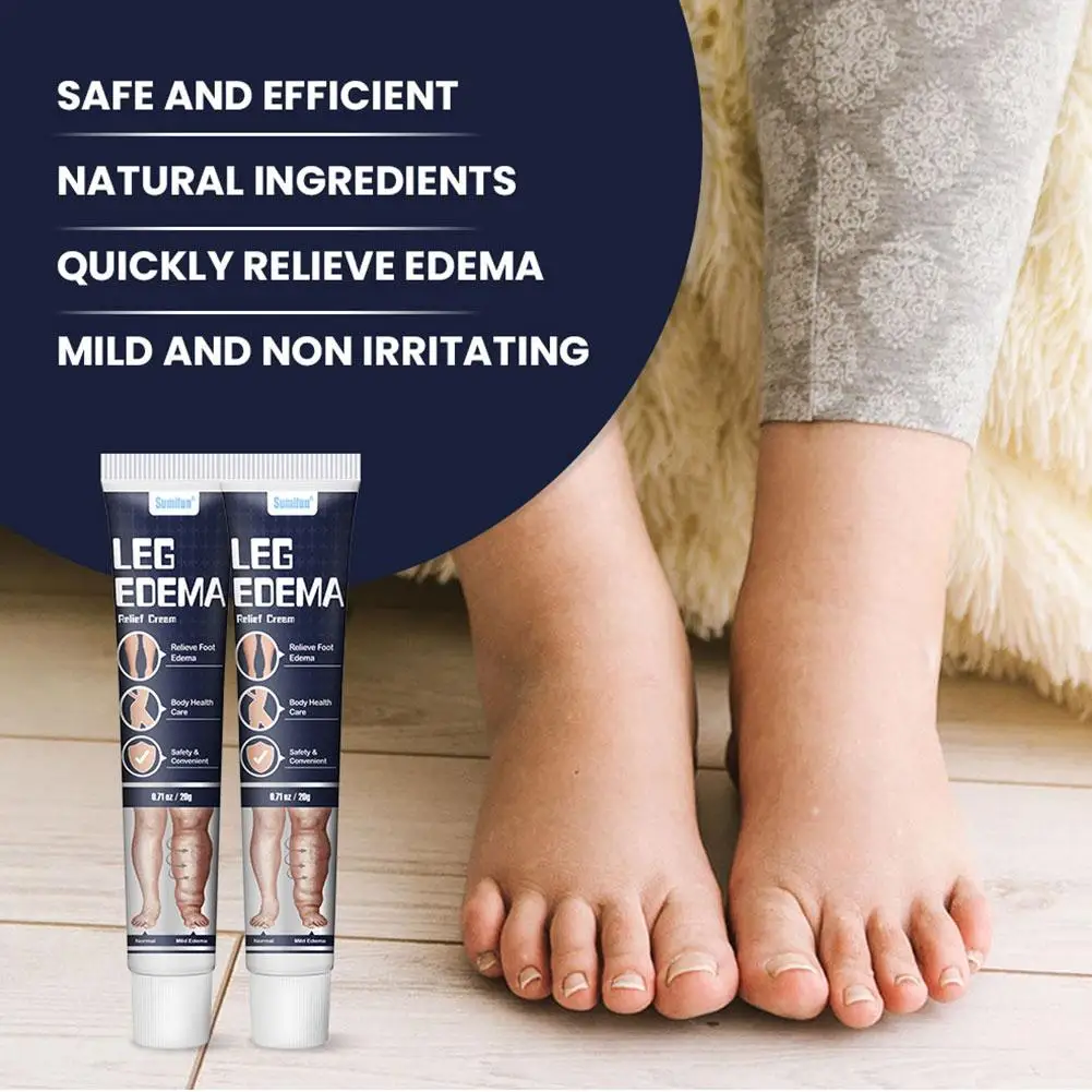 Crema per i piedi anti edema Massaggio ai piedi Crema sanitaria Alleviare efficacemente le vene varicose Braccio Gamba Gonfiore Dolore Crema rilassante