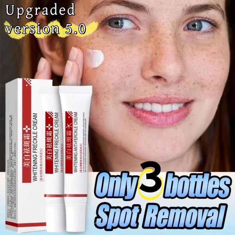 New Whitening Fade Spots Emulsion Remove Melasma Face Cream Dark Skin Face Quick Freckles Removal Cream Women Brighten Product