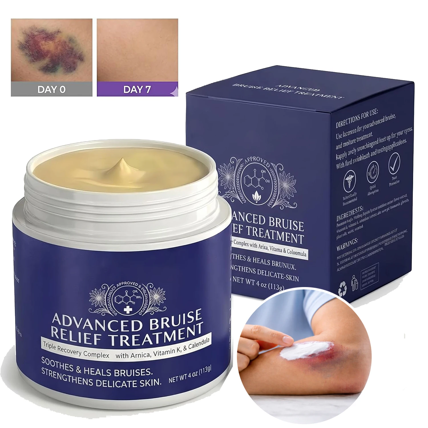 Arnica Bruise Cream Extra Acting for Bruising & Swelling on Thin Skin Advanced Formula Soothing Hydrating for Face and Body