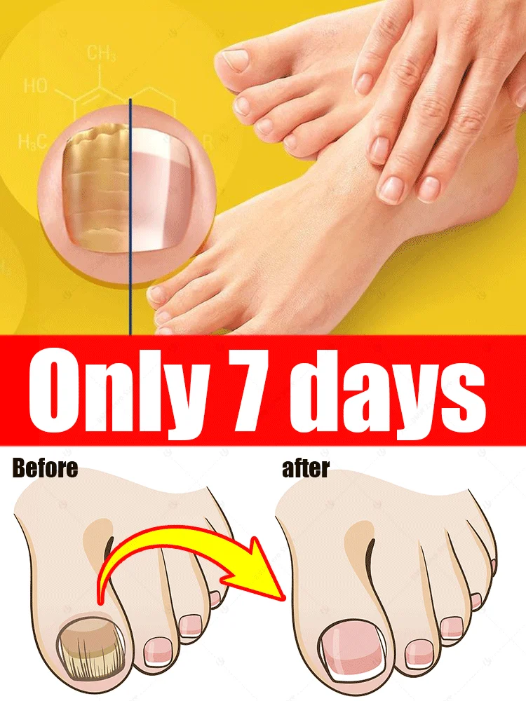

manicure for bad Can in 7 days farewell