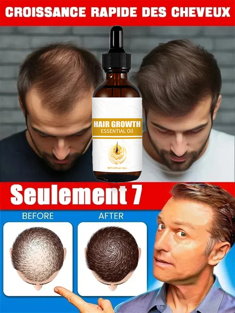 Hot sale, buyers will buy again, hair is getting more and more, say goodbye to baldness, sparse hair starts to become thick