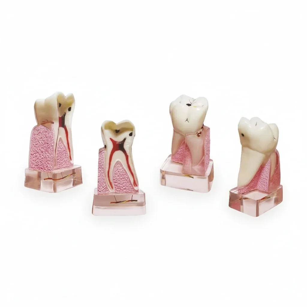 

Dental Pathological Model, 4x Magnified Anatomical Teeth Model, Eco-friendly PVC, Medical Educational Supply, Lab Tool