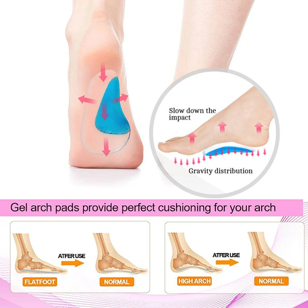 Orthopädische Einlegesohlen für Kinder, Schuheinlagen, Baby-Plantarfasziitis, Plattfüße, Fußgewölbeunterstützung, orthopädische Silikongel-Einlegesohlen – Detail 3