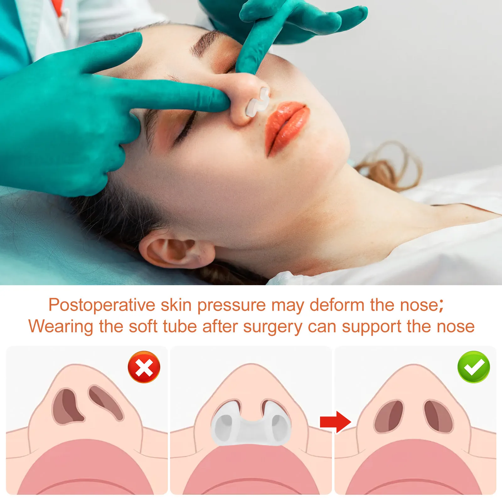 

Nostril Retainer After Surgery Nose Corrector Silicone Rhinoplasty Recovery Tool Internal Nose Support Fixator for Crooked Nose