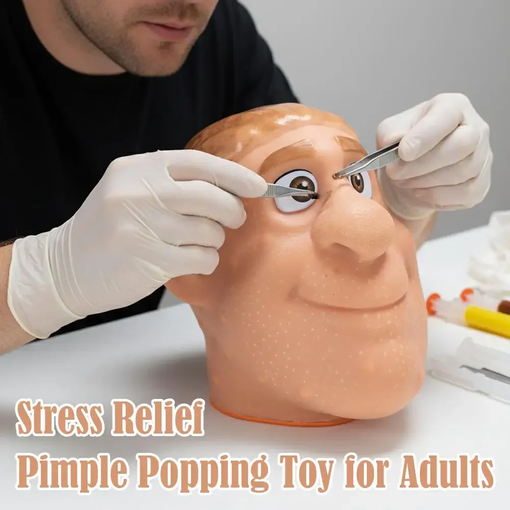 Stress Relief Acne Pimple Popping Toy with Man Head and Tweezers, Blackhead Removal Sensory Tool for Anxiety Decompression