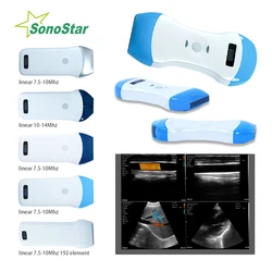 Sonostar Wireless Ultrasound Probe Scanner Machine Portable  WIFI linear or convex Machine support iOS Android Windows USG