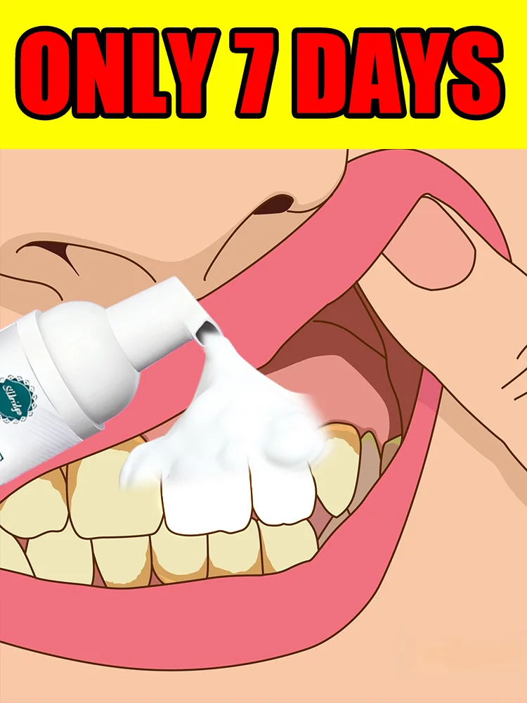 

2025 hotsale,clean teeth,oral foam,freeshipping,remove tartar