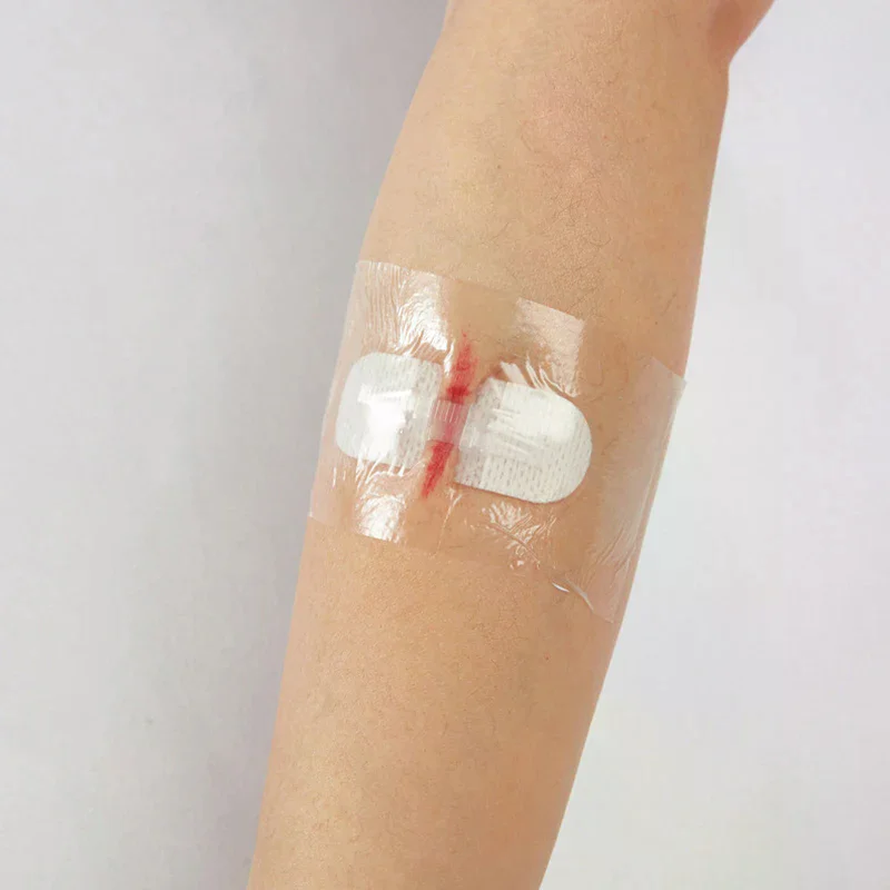 غرزة شريط لاصق مجاني لشرائط إغلاق الجروح الطبية الغرز الجراحية إصلاح الجروح بعد الولادة لاصق التجميل الطبي #2