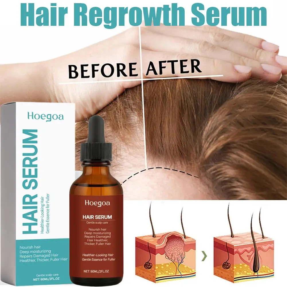 60 مللي مصل إعادة نمو الشعر أفريقيا مجنون الجر الثعلبة مصل مكافحة كسر الشعر رشاقته علاج تساقط الشعر رذاذ للرجل Wom P1G0