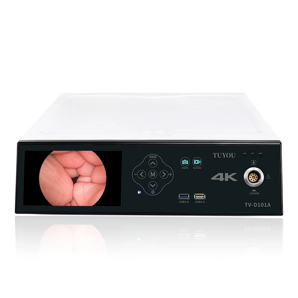 TUYOU 4k Uhd Medical Endoscopy Laparoscopic  System For Laparoscopy Hysteroscopy Diagnostic