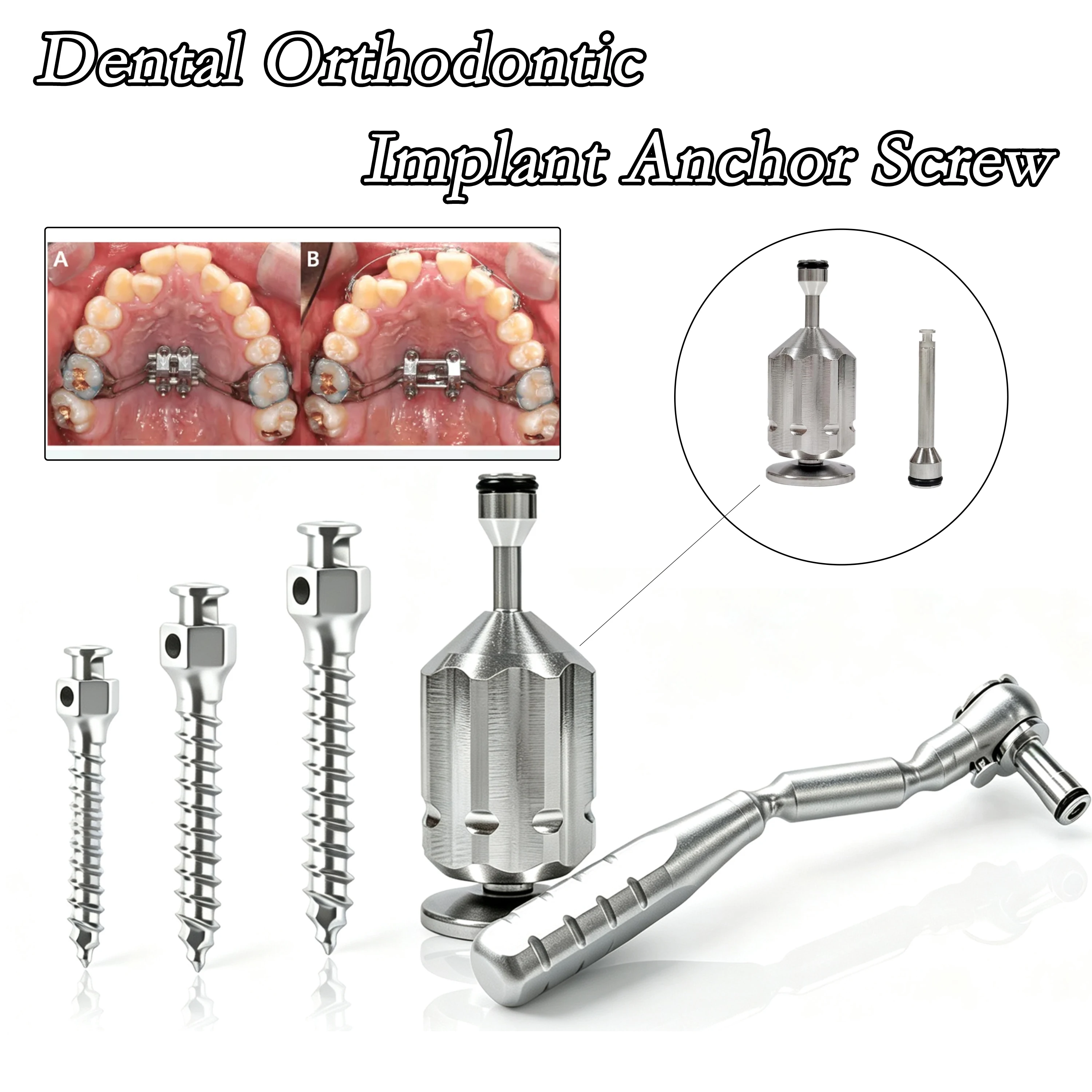 Kit de tournevis à cliquet pour vis d'expansion orthodontique dentaire, pour expanseur squelettique maxillaire et vis d'implant micro-mini orthodontique