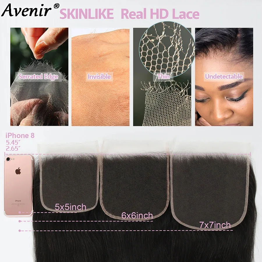 レースクロージャー