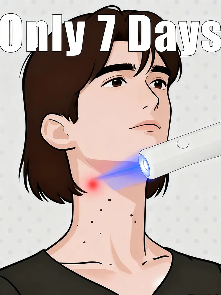 

Новая портативная легкая ручка с синим светом, Лидер продаж 2024, домашний уход за бородами, нежный уход за кожей, внешняя ручка унисекс