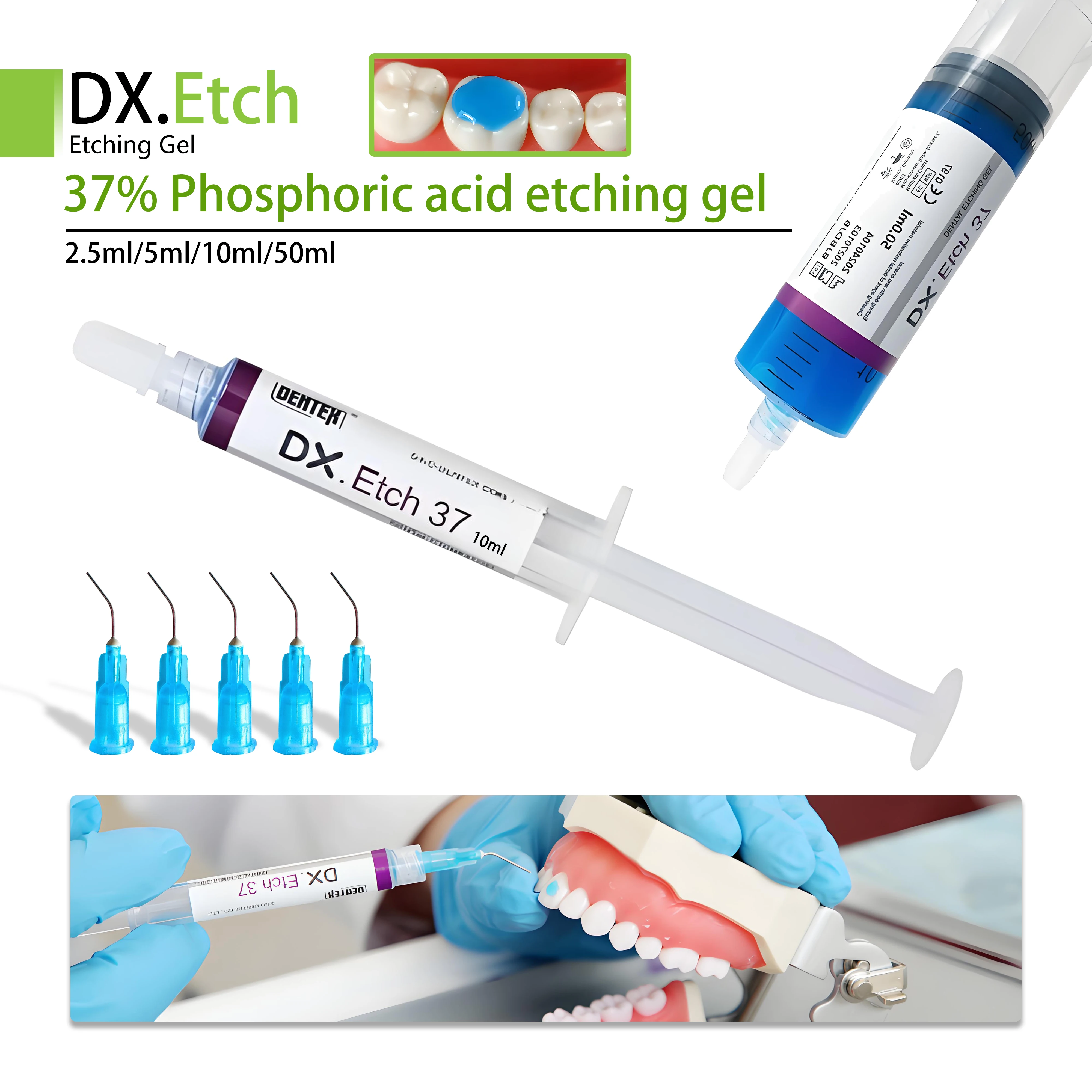 Zahnmedizin-Ätgel, 37 % Dentalmaterialien, Zahnreinigungskleber, Harzspangen, Bindungskleber, Phosphorsäure, Ätzer + 5 Spitzen