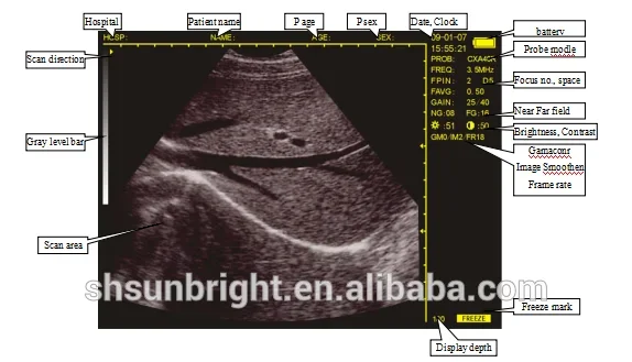 Ce Goedgekeurde Medische Draagbare Ultrasone Machine