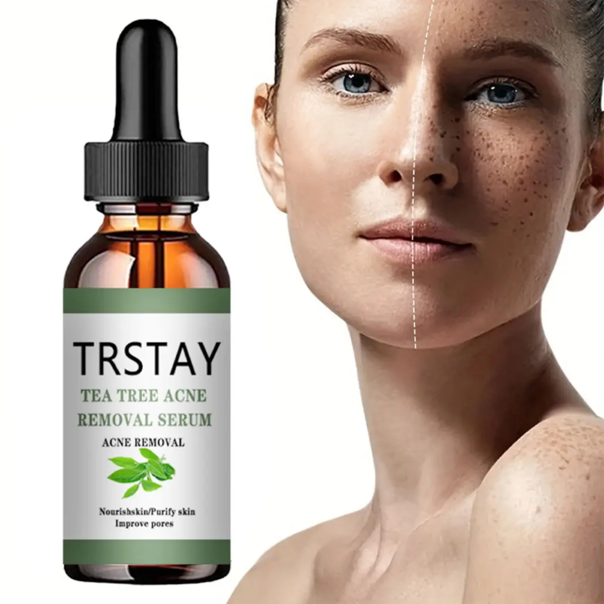 Acne Treatment Face Serum Tea Tree Oil Essence Moisturizing Shrink Pores Acne Facial Serum Korean Skin Care P