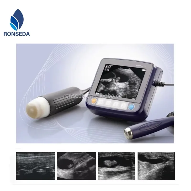 

Portable Ultrasonic Diagnostic Devices Type Portable Ultrasound scanner for Pets and Animal