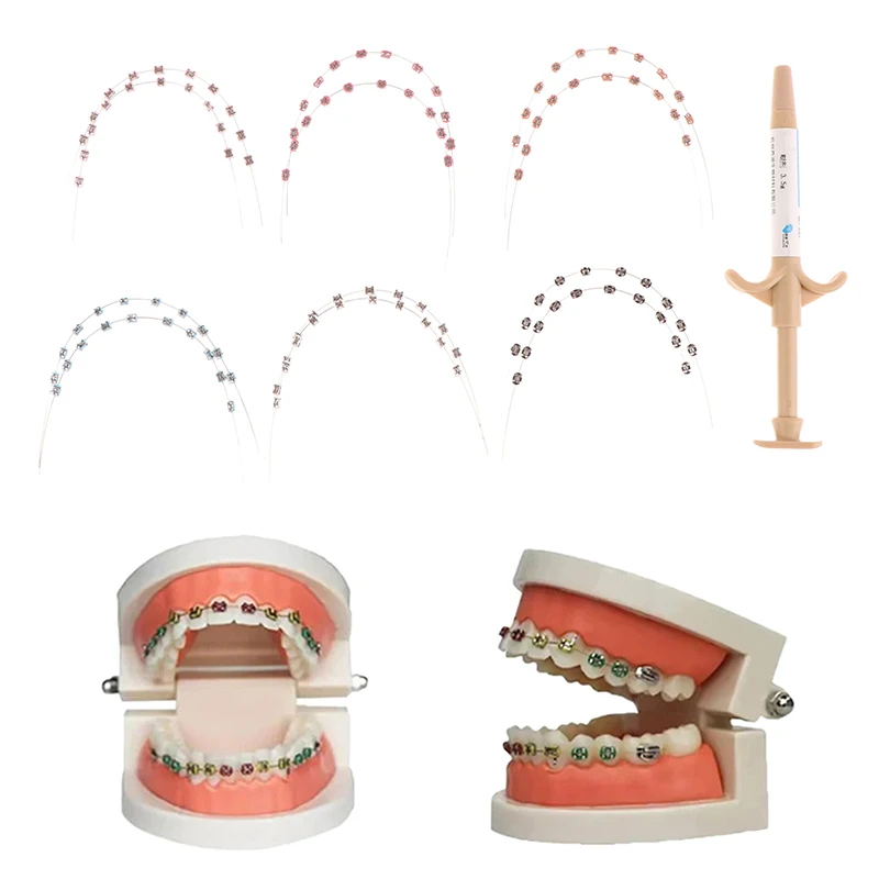 Temporary Tooth Decoration With Metal Wires Colorful Metal Bracket And Orthodontic Ligature Tie With Dental Light Curing Bonding