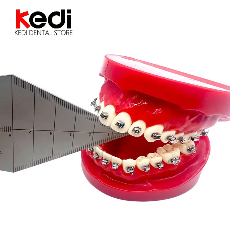 Tooth upper and lower distance measuring ruler Dental ruler Occlusal distance stainless steel Up and down distance measurement