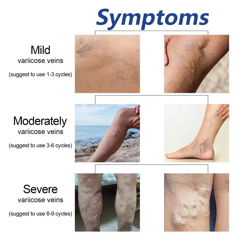 Самонагревающиеся лимфатические рукава, натуральные Самонагревающиеся рукава до колена, безопасные удобные Самонагревающиеся формирующие наколенники Mugwort