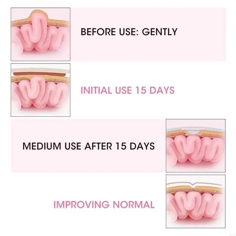 

E06F 2 Pcs Umbilical Hernia Therapy Belt Breathable Bag Elastic Cotton Strap for 0-1 Years Old Baby Children Infant