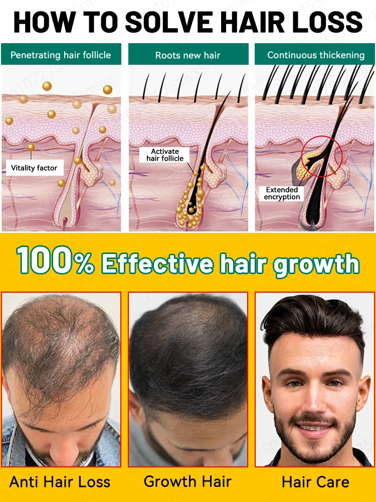 Unisex Growth Oil Hair Loss Treatment Rapid Hair Growth Effective Baldness Repaid Hereditary Postpartum Hair Loss Free Shipping