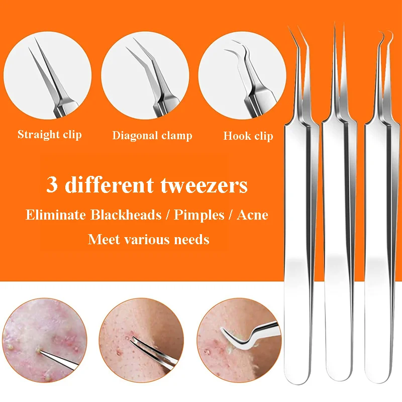 5PCS Blackhead Remover Comedone Extractor Curved Tweezers Professional Stainless Pimple Acne Needle Blemish Removal Tools Kit