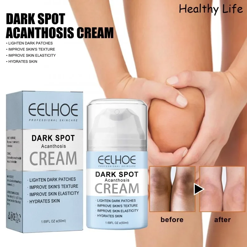 

Women Skin Brightening Cream Remove Dull Skin Emulsion Brighten Private Parts Lightening Cream Inner Thigh Butt Bleaching Serum
