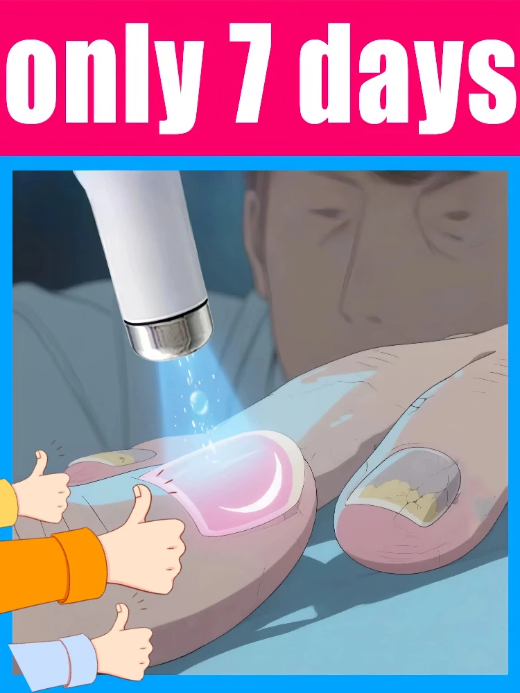 

25. Горячий: инструменты для чистки ногтей, лазерные инструменты с синим светом, ремонт корней, модернизированные в второе поколение.