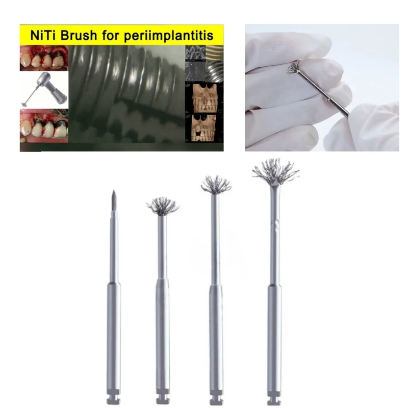 

Dental Autoclavable Debridement Peri-Implantitis Implant Surface Threads Titanium Brush for Implant Restoration Maintenance