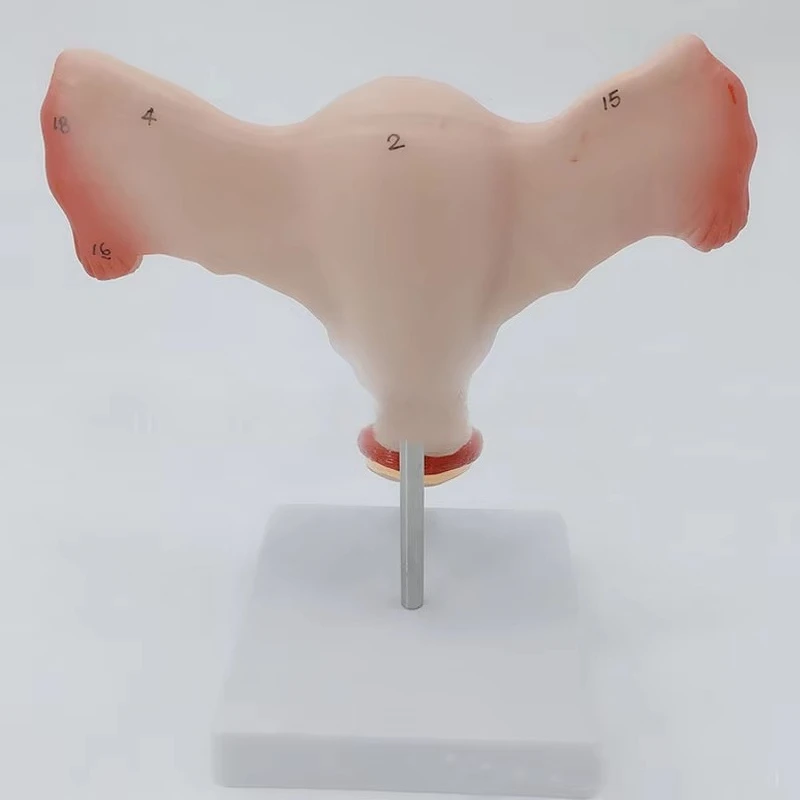 

Normal Bilateral Ovarian Uterus Medical Teaching Education Model