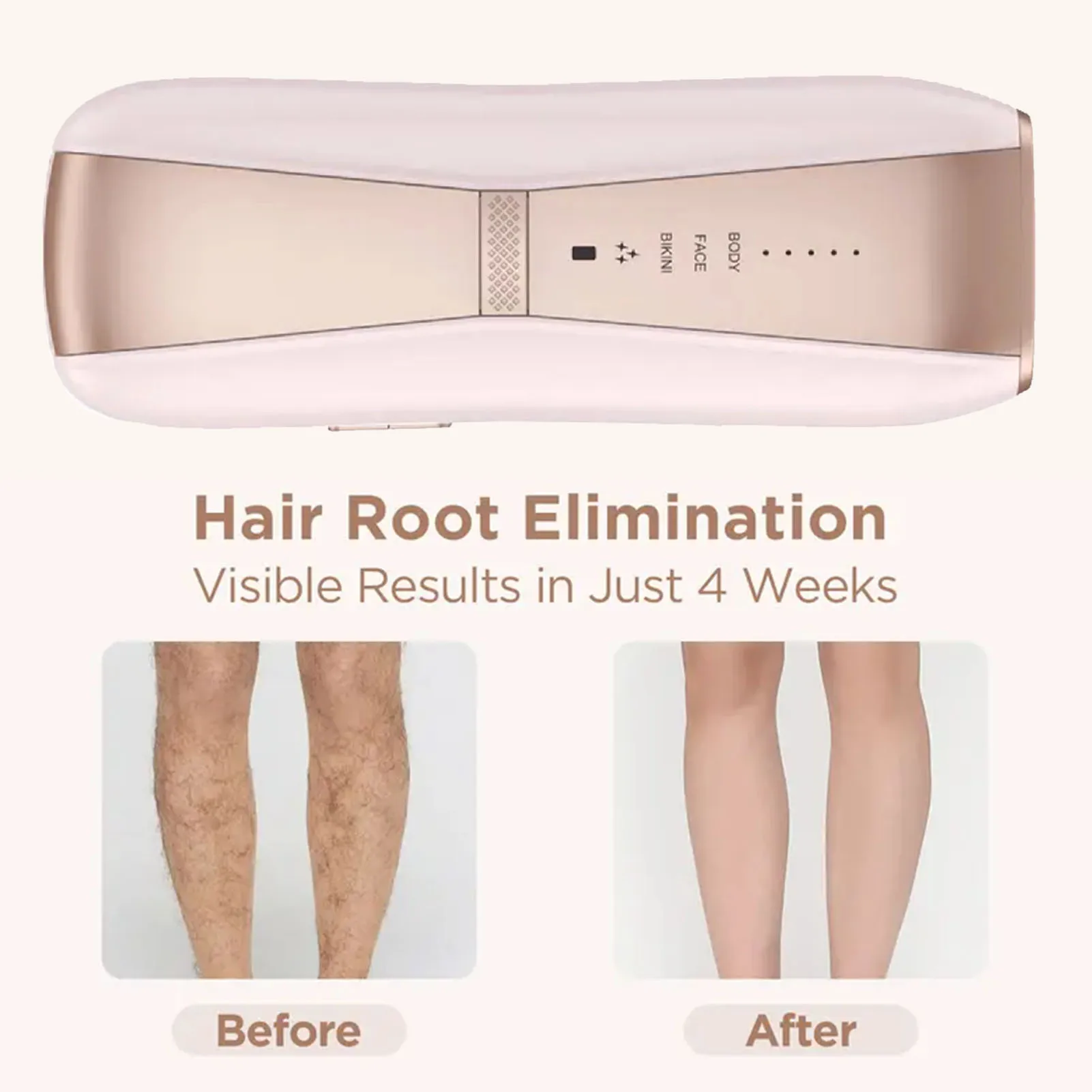 جهاز إزالة الشعر، أداة إزالة شعر الجسم الكهربائية المحمولة عالية الكفاءة للسفر في صالونات التجميل المنزلية