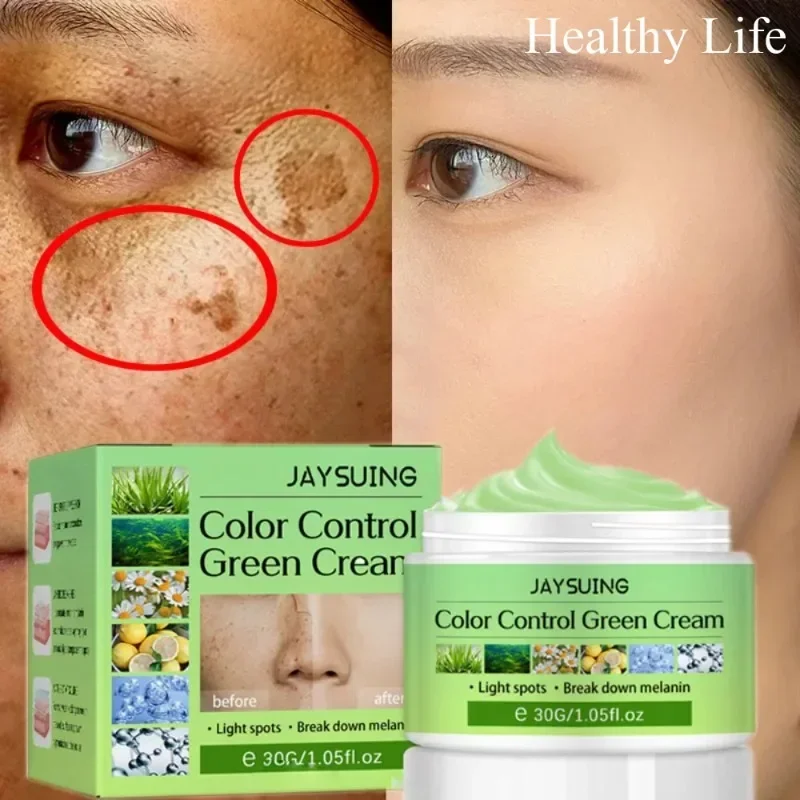 

Remove Melasma Fade Spots Cream Women Whitening Freckles Cream Face Lightening Brighten Serum Moisturize Anti-aging Skin Care