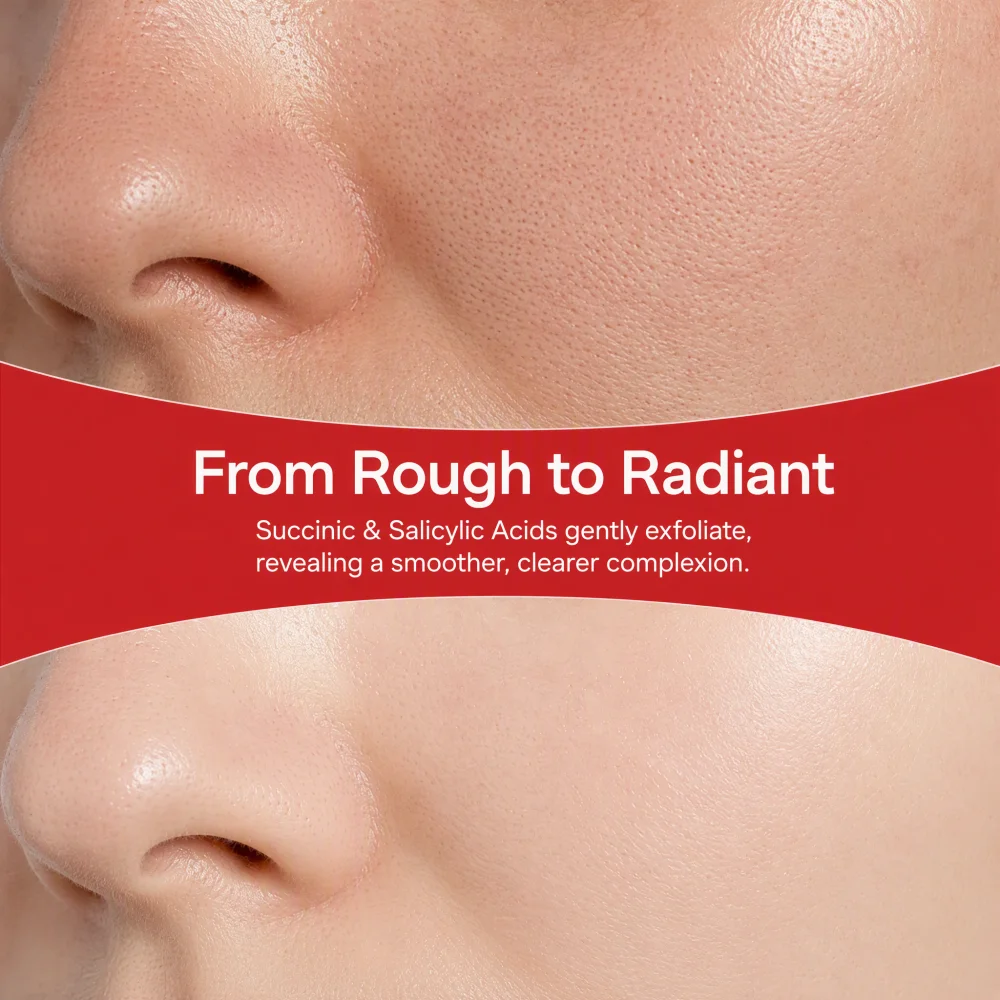 2026 New Red Succinic Acid & P - Skincare Non Comedogenic recension och pris