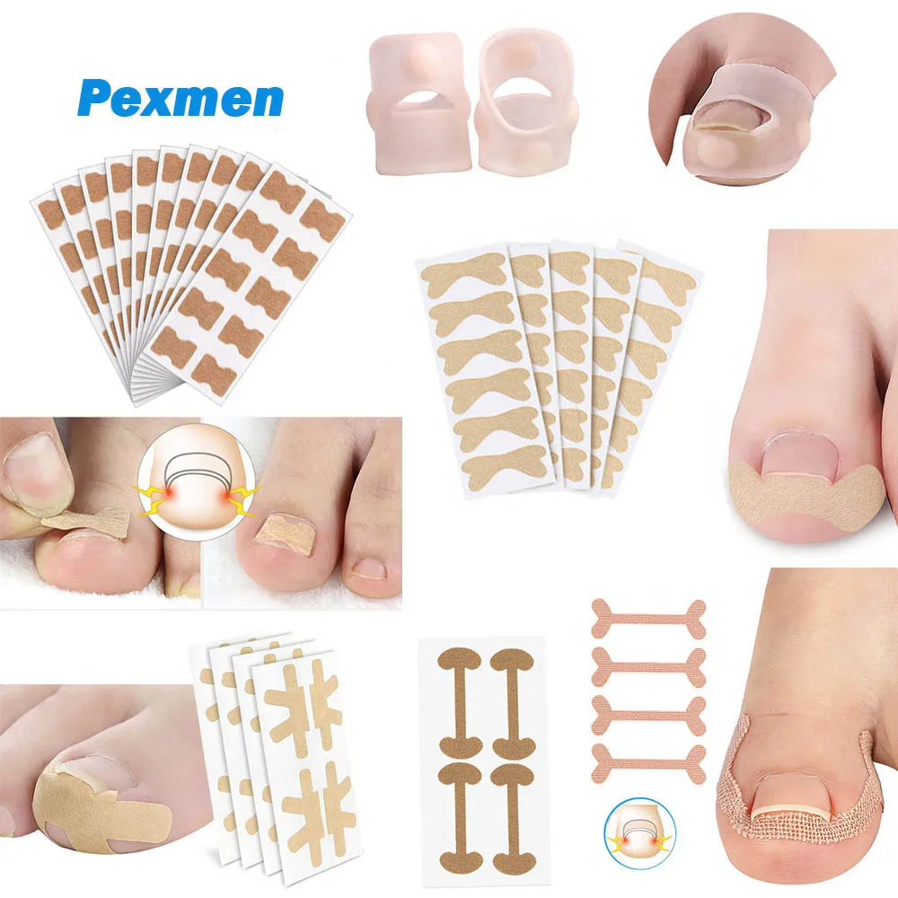 Pexmen 4/20/30/50Pcs Toenail Corrector Patch Nail Patches Ingrown Toenail Corrector Sticker Ingrown Toenail Treatment